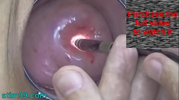 大Endoscope Camera inside Cervix Cam into Pussy Uterus新鲜的视频