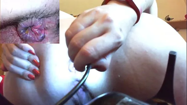Grote Medical anal endoscope fisting and extreme masturbation nieuwe video's