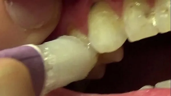 Μεγάλα Applying Whitening Paste To Her Filthy Teeth φρέσκα βίντεο