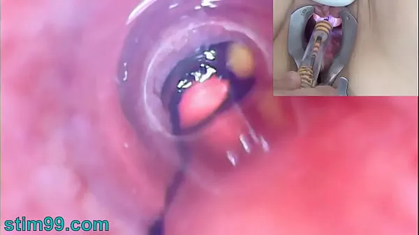 Store Mature Woman Peehole Endoscope Camera in Bladder with Balls nye videoer