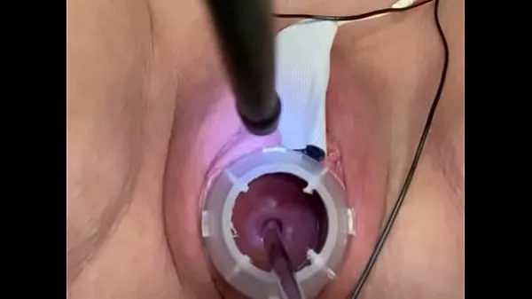 Painful electrosounding cervix Video baharu besar
