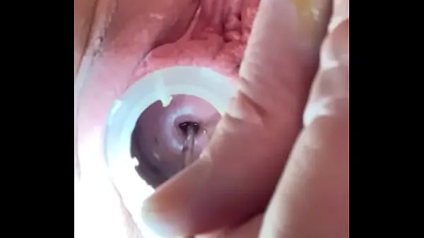 Video besar Deep cervical os dilation w painful sound segar