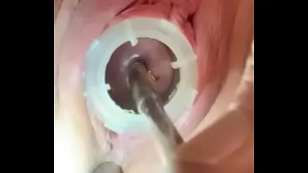 Big Watch 8mm electrosound puckering my cervix as I squeal from fresh Videos