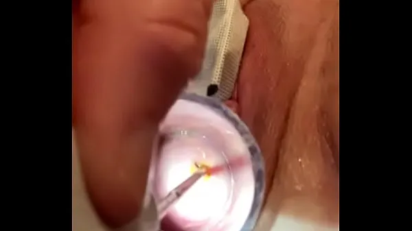 ใหญ่Muscle spasms cervix electrosoundวิดีโอสด
