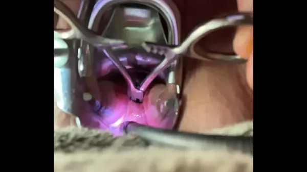 Veliki Pain opening hemastats while inside cervix sveži videoposnetki