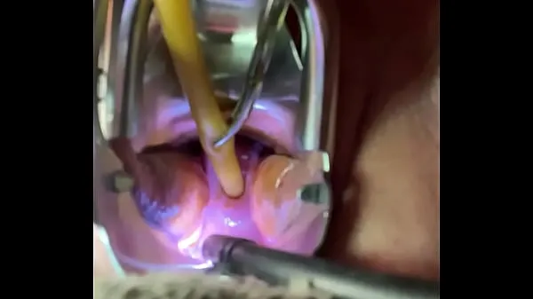 大Catheterizing uterus painfully新鲜的视频