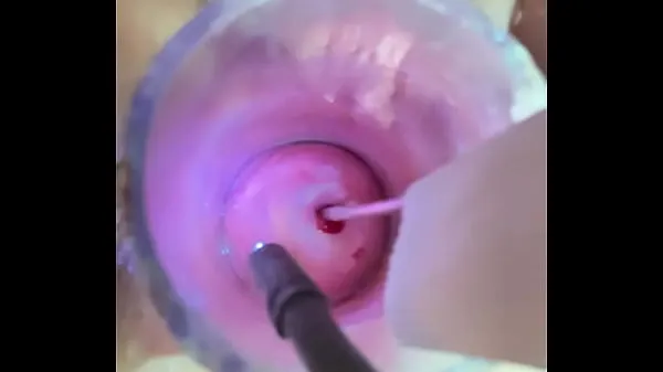 Grote Estim in cervix and ass spasming nieuwe video's