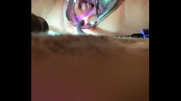 Internal view of Orgasm w sound tenaculum and vibrator Video baharu besar