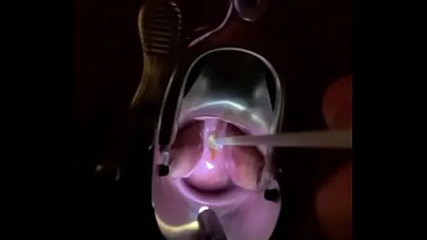 Čerstvá videa Fucking cervix w painful brush velké