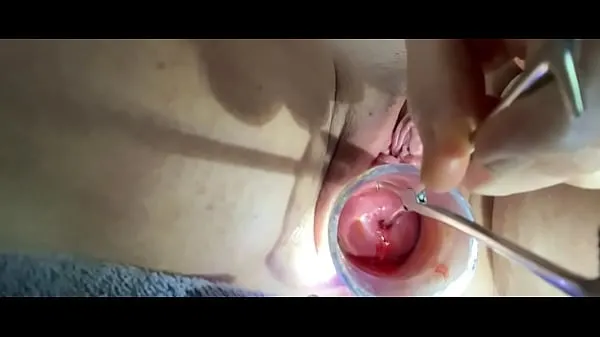 Μεγάλα Sound tenaculum controlling uterus φρέσκα βίντεο